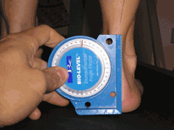 Treatments and Fees. heel angle